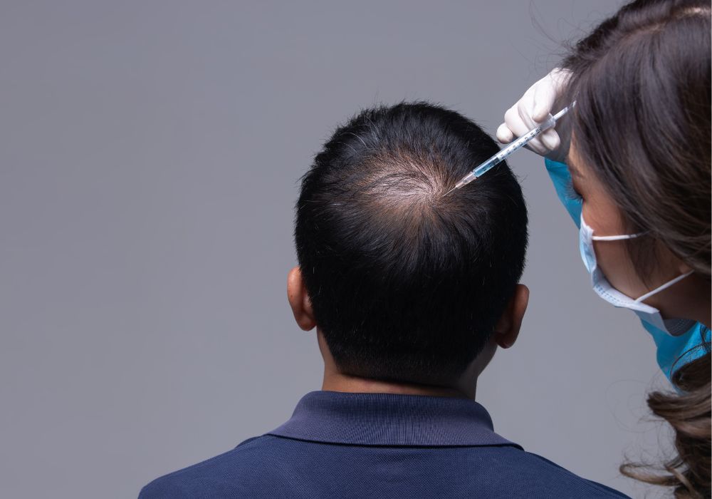 Hair transplantation – Dr. Hamad Beauty Clinic Hair transplantation – Dr. Hamad Beauty Clinic
